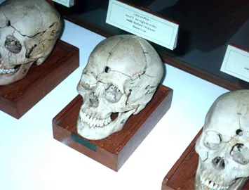 Forensic Medicine